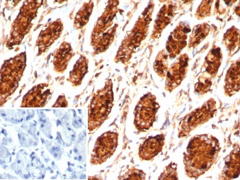 IHC staining of FFPE human stomach tissue with MUC5AC antibody (clone MUC5AC/7798R). Inset: PBS used