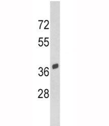 Western blot analysis of SPARC antibody and Y79 lysate. Predicted molecular weight 35-45 kDa dependi