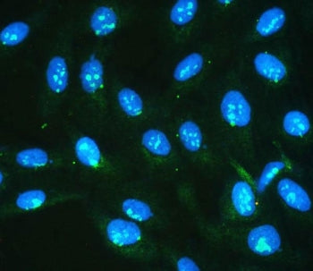 IKK gamma Antibody / NEMO