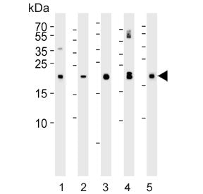 Western blot testing of 1) human kidney, 2) human plasma, 3) mouse kidney, 4) mouse plasma and 5) ra