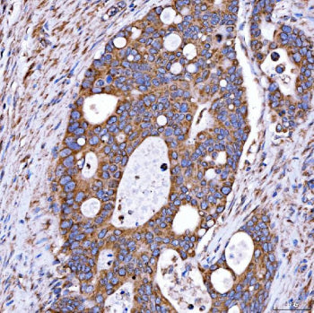 RAB7A Antibody / Ras-related protein Rab-7a, 100ug