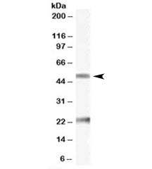 Western blot testing of human ovay lysate with Fibulin 5 antibody at 0.1ug/ml. The expected ~50kDa b