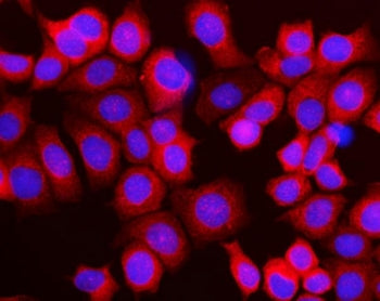 Immunofluorescent staining of FFPE human MCF7 cells with RPL10 antibody (red) and DAPI nuclear stain