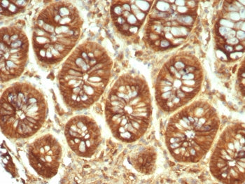 IHC staining of FFPE human colon tissue with Alpha-2-Macroglobulin antibody (clone A2M/6550). HIER: 