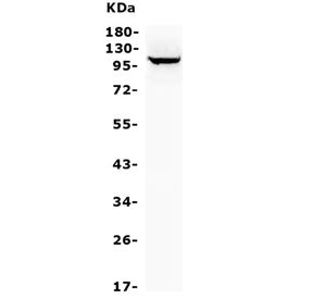 Western blot testing of human HepG2 cell lysate with MTTP antibody. Predicted molecular weight ~99 k