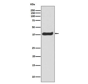 Western blot testing of human Jurkat lysate with phospho-LAT antibody. Expected molecular weight: 36