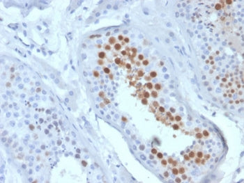 KIF2C Antibody / MCAK