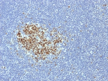 IHC testing of FFPE human tonsil tissue with Bcl6 antibody (clone BCL6/1718). HIER: boil tissue sect