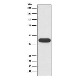 Western blot testing of human K562 cell lysate with CD32 antibody. Expected molecular weight: 34-40 