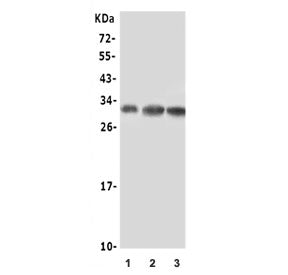Western blot testing of human 1) U-87 MG, 2) 22RV1 and 3) A549 lysate with Beta NGF antibody. Predic