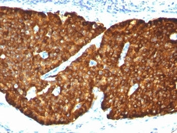 Chromogranin A Antibody