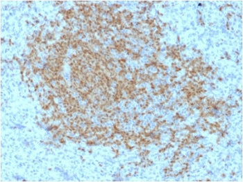 IHC testing of FFPE human spleen with BOB1 antibody (clone BOB1/2423). HIER: boil tissue sections in