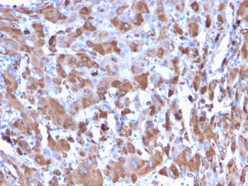 IHC staining of FFPE human liver with C1QA antibody. HIER: boil tissue sections in pH 9 10mM Tris wi