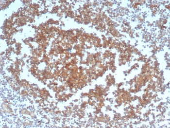 IHC staining of FFPE human tonsil tissue with recombinant CD40 antibody (clone C40/4826R). HIER: boi