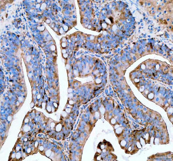 IHC staining of FFPE zebrafish colon tissue with Zebrafish Psmc4 antibody, HRP secondary and DAB sub
