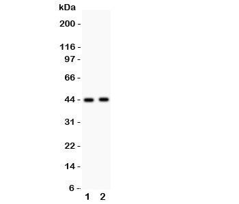 Western blot testing of E2F4 antibody and Lane 1: rat lung; 2: human SMMC-7721 lysate. Expected mole