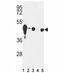 Western blot analysis of NSE antibody and (1) mouse cerebellum tissue and (2) Y79, (3) HepG2, (4) Ju