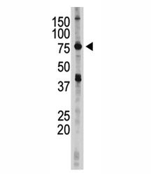 IKKE Antibody