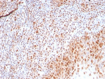 IHC staining of FFPE human tonsil tissue with recombinant PCNA antibody (clone rPCNA/8858) at 2ug/ml
