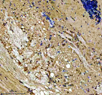 Immunohistochemical analysis of Lsg1 protein using Zebrafish Lsg1 antibody, HPR secondary and DAB su