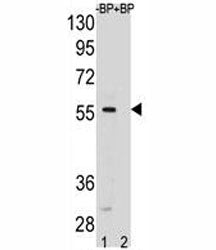 SMAD5 antibody pre-incubated without (lane 1) and with (2) blocking peptide in HeLa lysate. Observed
