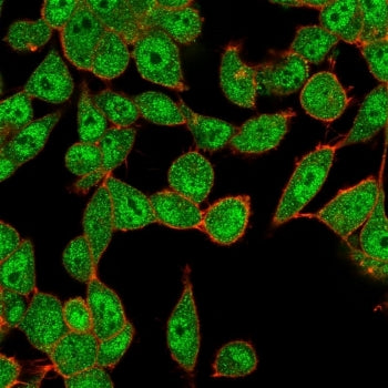 Immunofluorescent staining of PFA-fixed human HeLa cells using UBE2B antibody (green, clone PCRP-UBE