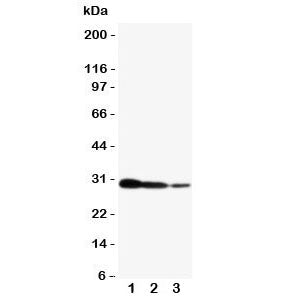 Western blot testing of CRTC2 antibody and human recombinant protein, 29KD with tag; Lane 1:10ng; 2: