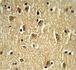 IHC testing of FFPE human brain tissue with PTK2 antibody. HIER: steam section in pH6 citrate buffer