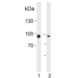 Western blot testing of human 1) HUVEC and 2) K562 cell lysate with Protein-glutamine gamma-glutamyl