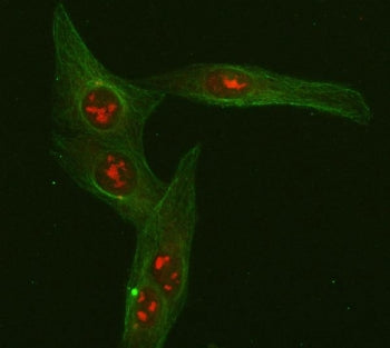 FOXO3A Antibody