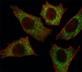 Fluorescent image of C2C12 cell stained with B-RAF antibody at 1:25. Immunoreactivity is localized t