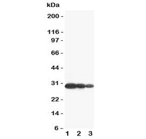 Western blot testing of Aquaporin 6 antibody and Lane 1: U87; 2: COLO320; 3: MCF-7 cell lysate