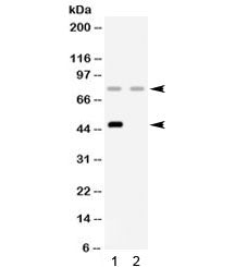 Complement Factor I Antibody / CFI