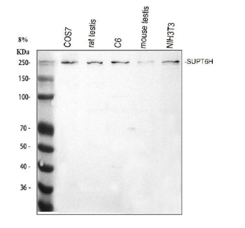 Western blot analysis of SUPT6H using anti-SPT6 antibody. Electrophoresis was performed on a 8% SDS-