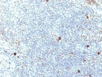 IHC: Formalin-fixed, paraffin-embedded human tonsil stained with HLA-Aw32 / HLA-A25 antibody (SPM417