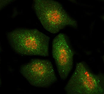Immunofluorescent staining of FFPE human A549 cells with DBF4 antibody (red) and Beta Actin antibody
