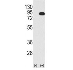 Western blot analysis B-RAF antibody and 293 cell lysate (2 ug/lane) either nontransfected (Lane 1) 
