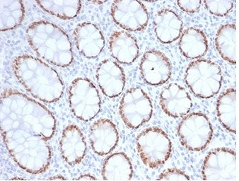 IHC staining of FFPE human colon tissue with SATB2 antibody (clone SATB2/7111). HIER: boil tissue se