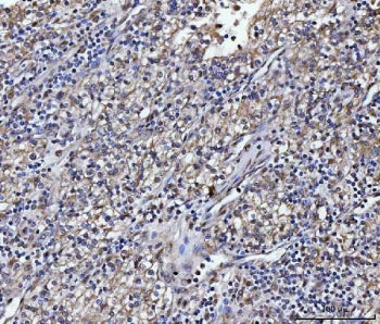 ATP1B2 Antibody