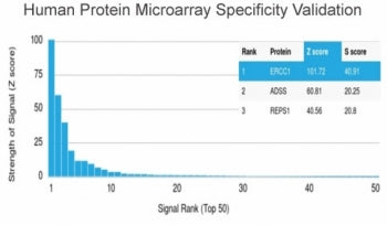 Analysis of HuProt(TM) microarray containing more than 19,000 full-length human proteins using ERCC1