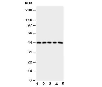 PGE Receptor Antibody, EP1 subtype