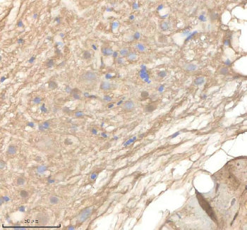 IHC staining of zebrafish Ppm1g protein using Zebrafish Ppm1g antibody, HRP-labeled secondary and DA