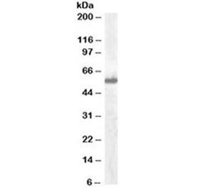 Western blot testing of A549 lysate with IRF5 antibody at 0.1ug/ml. Predicted molecular weight ~57 k