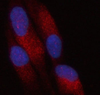 PATL2 Antibody / PAT1-like protein 2