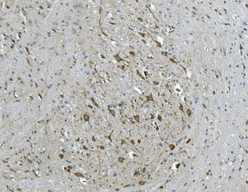 IHC staining of FFPE mouse brain tissue with GABRG2 antibody. HIER: boil tissue sections in pH8 EDTA