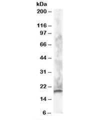 Western blot testing of human brain lysate with CABP1 antibody at 1ug/ml. Predicted molecular weight