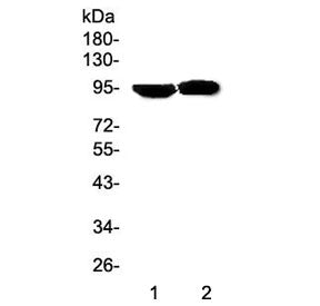Western blot testing of Prolactin Receptor antibody and Lane 1: human HeLa; 2: human MCF-7 cell lysa