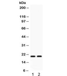 Western blot testing of 1) rat heart and 2) rat muscle lysate with HSPB2 antibody. Predicted/observe