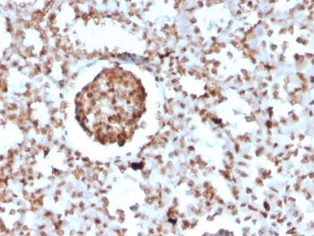 IHC staining of BrdU-incorporated FFPE mouse kidney with BrdU antibody (clone BRD2888R). HIER: boil 