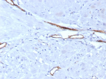IHC staining of FFPE human uterus tissue with vWF antibody (clone VWF/7979R). HIER: boil tissue sect